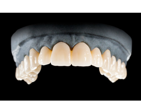 DD Nacera® Pearl Natural, multilayer zirkon, translucentní, A2, 16 mm