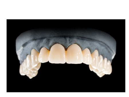 DD Nacera® Pearl Natural, multilayer zirkon, translucentní, 0M3, 16 mm
