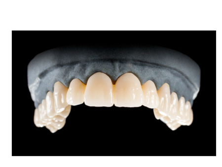 DD Nacera® Pearl Natural, multilayer zirkon, translucentní, 0M3, 20 mm