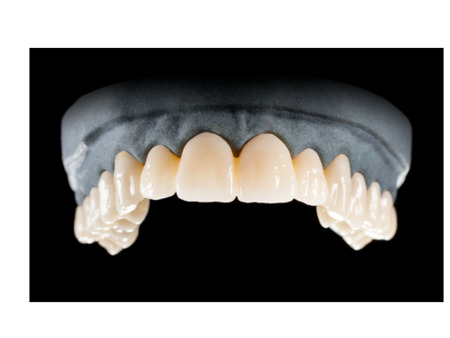 DD Nacera® Pearl Natural, multilayer zirkon, translucentní, 0M3, 25 mm