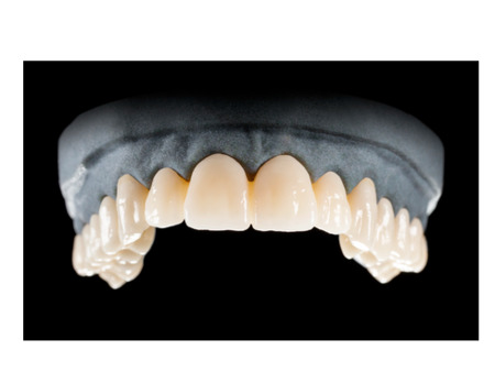 DD Nacera® Pearl Natural, multilayer zirkon, translucentní, A1, 16 mm
