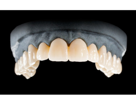 DD Nacera® Pearl Natural, multilayer zirkon, translucentní, A1, 20 mm