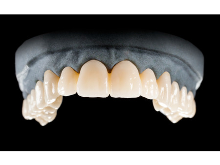 DD Nacera® Pearl Natural, multilayer zirkon, translucentní, A3, 20 mm