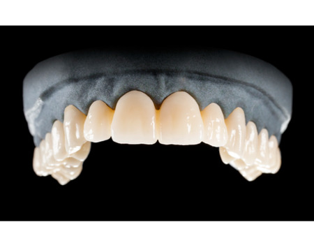 DD Nacera® Pearl Natural, multilayer zirkon, translucentní, A3, 25 mm