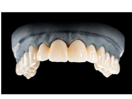 DD Nacera® Pearl Natural, multilayer zirkon, translucentní, A3,5; 16 mm