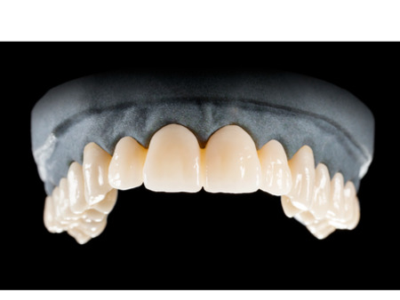 DD Nacera® Pearl Natural, multilayer zirkon, translucentní, A3,5; 25 mm