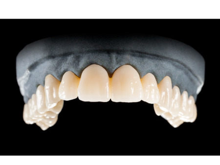 DD Nacera® Pearl Natural, multilayer zirkon, translucentní, A4, 16 mm