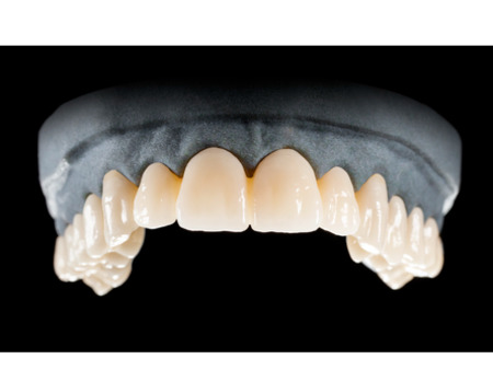 DD Nacera® Pearl Natural, multilayer zirkon, translucentní, B1, 16 mm