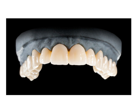DD Nacera® Pearl Natural, multilayer zirkon, translucentní, B1, 20 mm