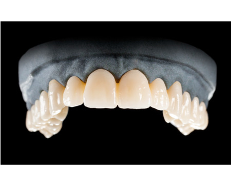 DD Nacera® Pearl Natural, multilayer zirkon, translucentní, B2, 16 mm