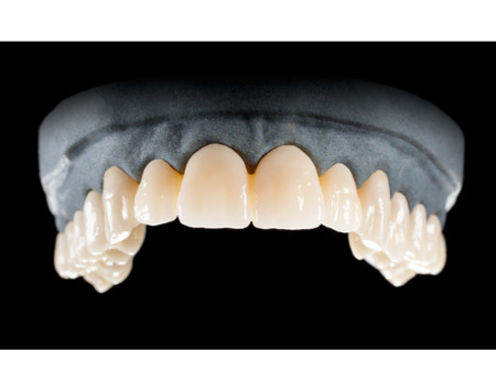 DD Nacera® Pearl Natural, multilayer zirkon, translucentní, B3, 16 mm