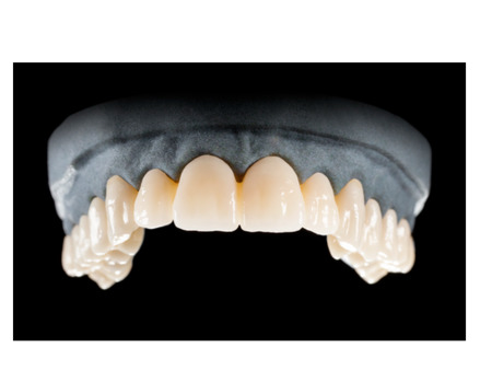 DD Nacera® Pearl Natural, multilayer zirkon, translucentní, B4, 20 mm
