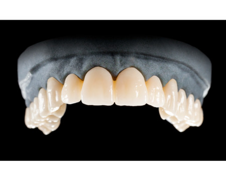 DD Nacera® Pearl Natural, multilayer zirkon, translucentní, C1, 25 mm