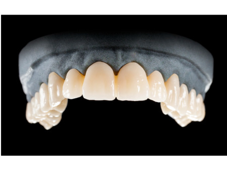 DD Nacera® Pearl Natural, multilayer zirkon, translucentní, C4, 16 mm