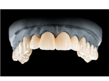 DD Nacera® Pearl Natural, multilayer zirkon, translucentní, C4, 20 mm