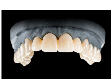 DD Nacera® Pearl Natural, multilayer zirkon, translucentní, C4, 25 mm