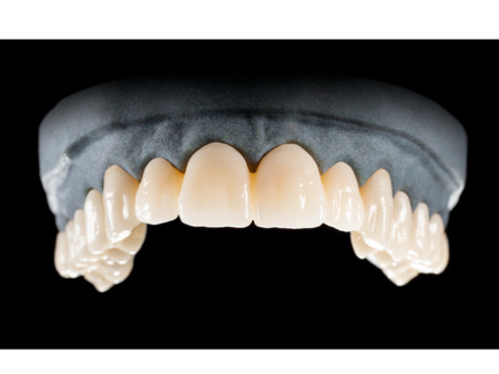 DD Nacera® Pearl Natural, multilayer zirkon, translucentní, D2, 16 mm