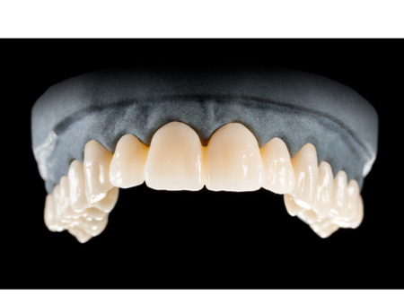 DD Nacera® Pearl Natural, multilayer zirkon, translucentní, D3, 25 mm
