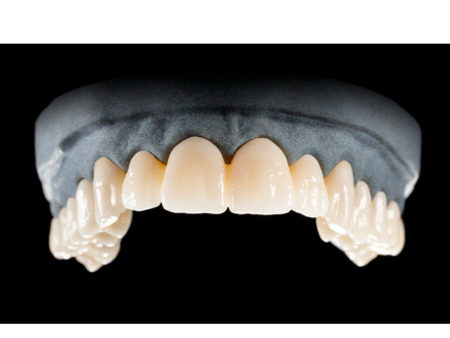 DD Nacera® Pearl Natural, multilayer zirkon, translucentní, D4, 16 mm