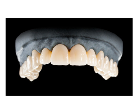 DD Nacera® Pearl Natural, multilayer zirkon, translucentní, Stellar White, 25 mm