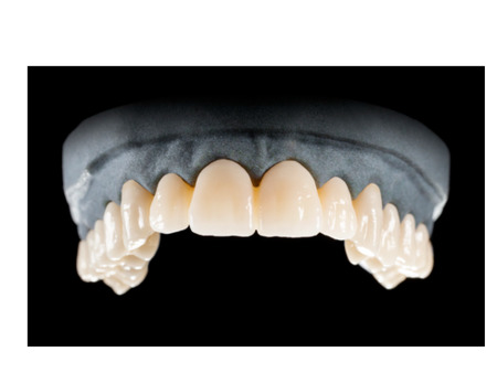 DD Nacera® Pearl Natural, multilayer zirkon, translucentní, 0M2, 25 mm