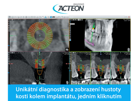 Acteon Satelec CBCT X-Mind Trium low dose 3D PAN