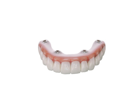 SprintRay OnX Tough 2 B1 500g