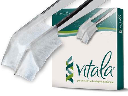 Vitala® 30 mm x 40 mm extra tenká Porcine Pericardium Collagen Membrane