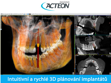 Acteon Satelec CBCT X-Mind PRIME 3D PAN FOV 12x10