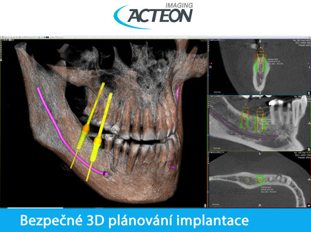 Acteon Satelec CBCT X-Mind PRIME wall 3D PAN FOV 12x10